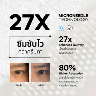 [2 Packs] The Awesome Patch – กู้รอยคล้ำใต้ตาแบบเร่งด่วน มาร์กเข็มลดริ้วรอย ไมโครนีดเดิล 1,800 เข็ม | By Moonshot Labs