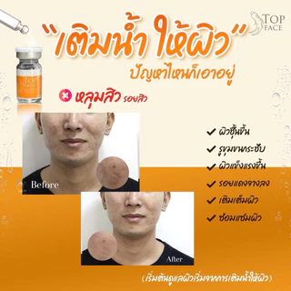 TOP FACE Intensify Treatment Serum อย.ไทย ✅เช็คแท้ถูกชัวร์ [1ขวด×5ml]