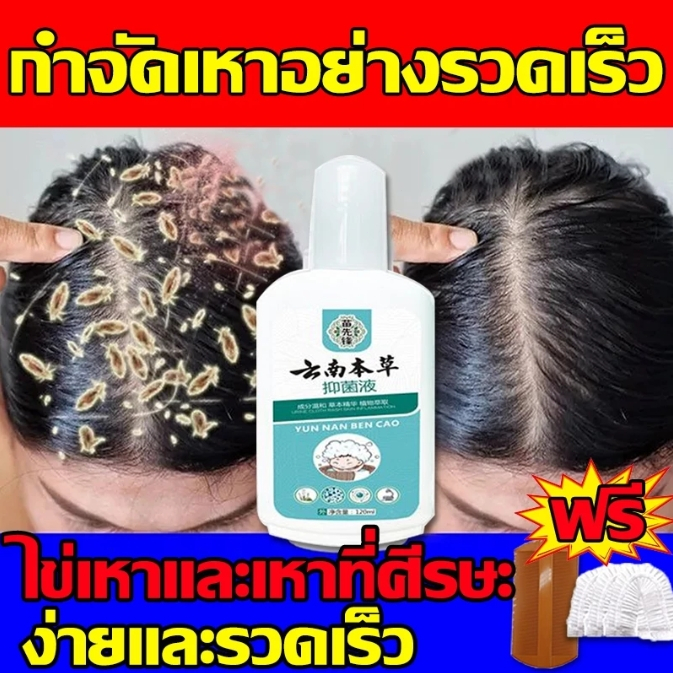 【ขจัดเหาถึง100%】แชมพูกำจัดเหา แชมพูเด็ก แก้คัน สมุนไพร100% กำจัดเหาที่ศีรษะ เหาตัว ไข่เหา และเหาหัวหน่าวได้อย่างรวดเร็