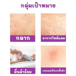ลอทใหม่ Sudocrem ของแท้ 100% ซูโดครีม กระปุกใหญ่125g. ครีมทาก้นเด็ก ครีมทาผื่นผ้าอ้อม