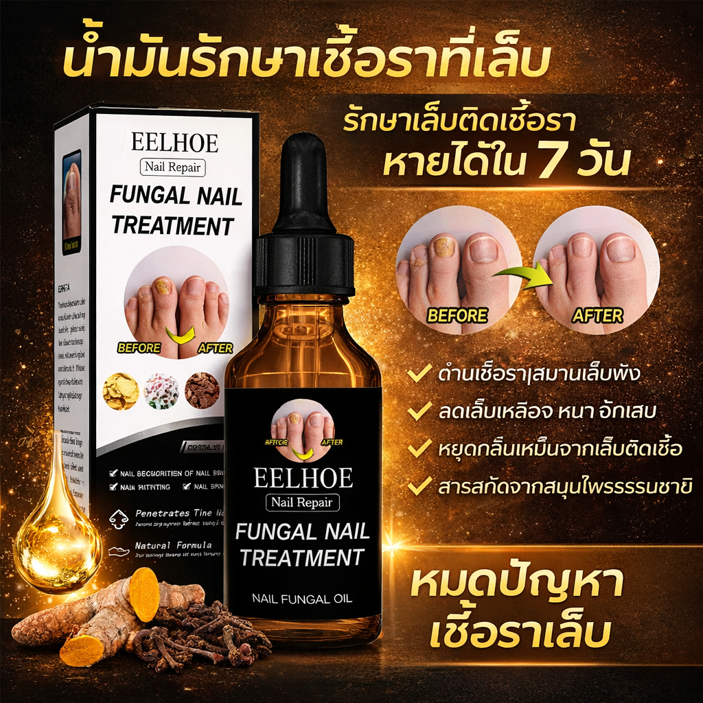EELHOE Nail Repair น้ำยารักษาเชื้อราที่เล็บ ลดเล็บเหลือง เล็บหนา เล็บติดเชื้อ กลิ่นไม่พึงประสงค์ ฟื้นฟูเล็บแข็งแรง