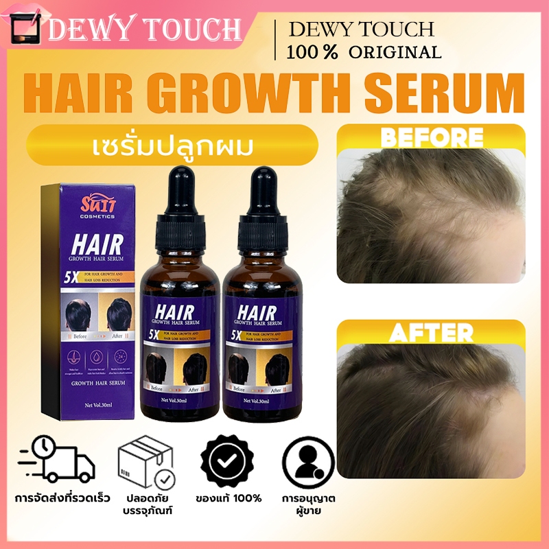 🔥ซื้อ 1 แถม 1🔥เซรั่มปลูกผม |เซรั่มบํารุงผม บํารุงผม รากผมแข็งแรง Hair Essence ลดหลุดร่วง เร่งผมยาว