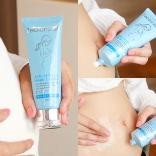 ครีมดูแลปัญหารอยแตกลาย Zeblanc Stretch Mask Cream ด้วยสารสกัดจากธรรมชาติ แนะนำสำหรับคุณแม่ตั้งครรภ์และหลังคลอด