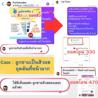 ชุดสิวหายด่วน (โฟม40g 1 แต้มสิว 2) DERRATU สิวอุดตัน สิวอักเสบ รอยดำสิว