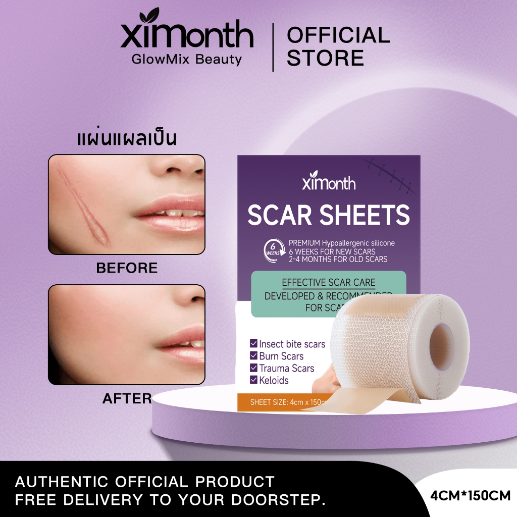 Ximonth แผ่นแปะแผลเป็น แผ่นแปะซิลิโคน แผ่นแปะลดรอยแผลเป็นนูน รักษารอยแผลเป็น ลดรอยแผลเป็น