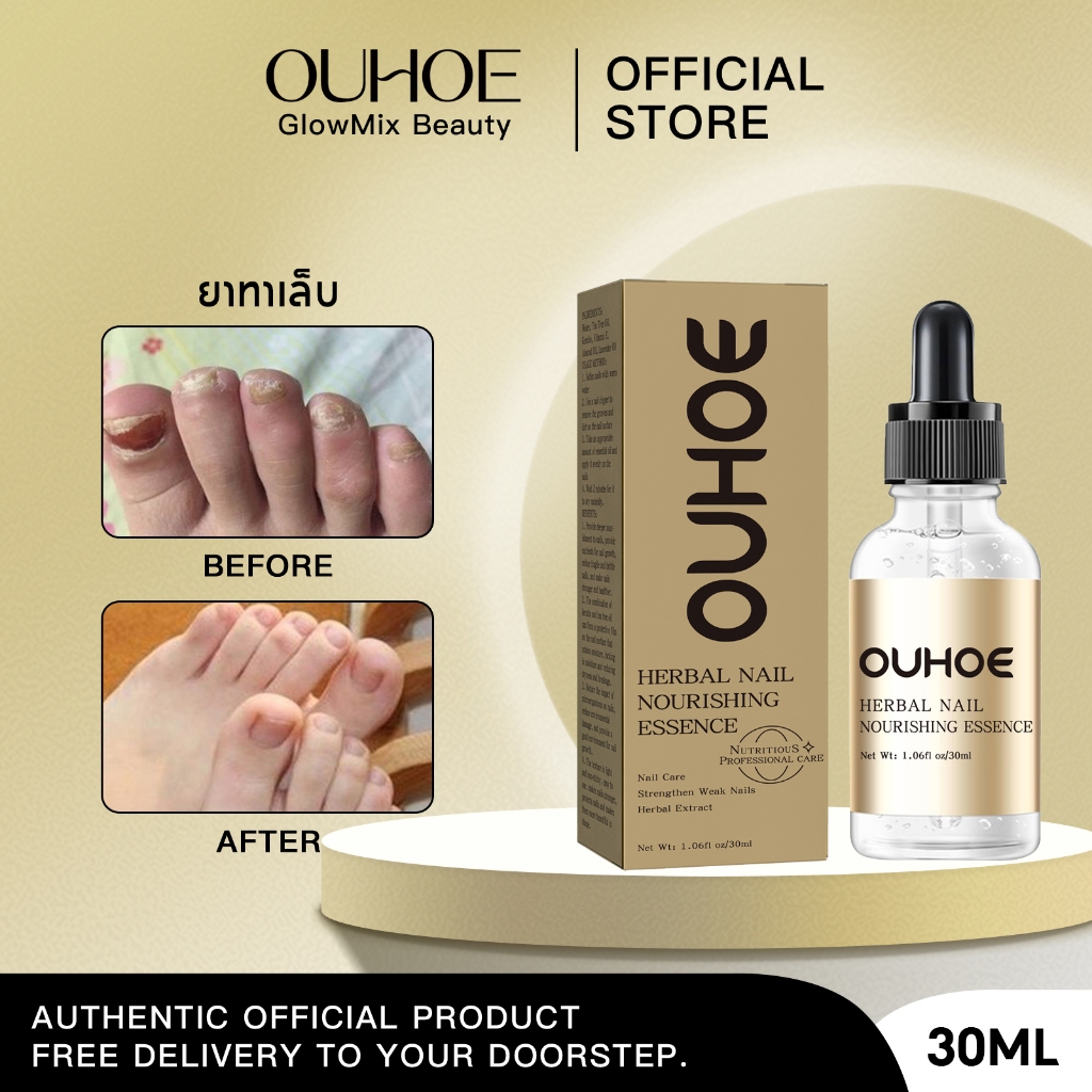 OUHOE น้ำยาซ่อมแซมเล็บ น้ำยารักษาเชื้อราที่เล็บ น้ำยาซ่อมแซมเล็บ