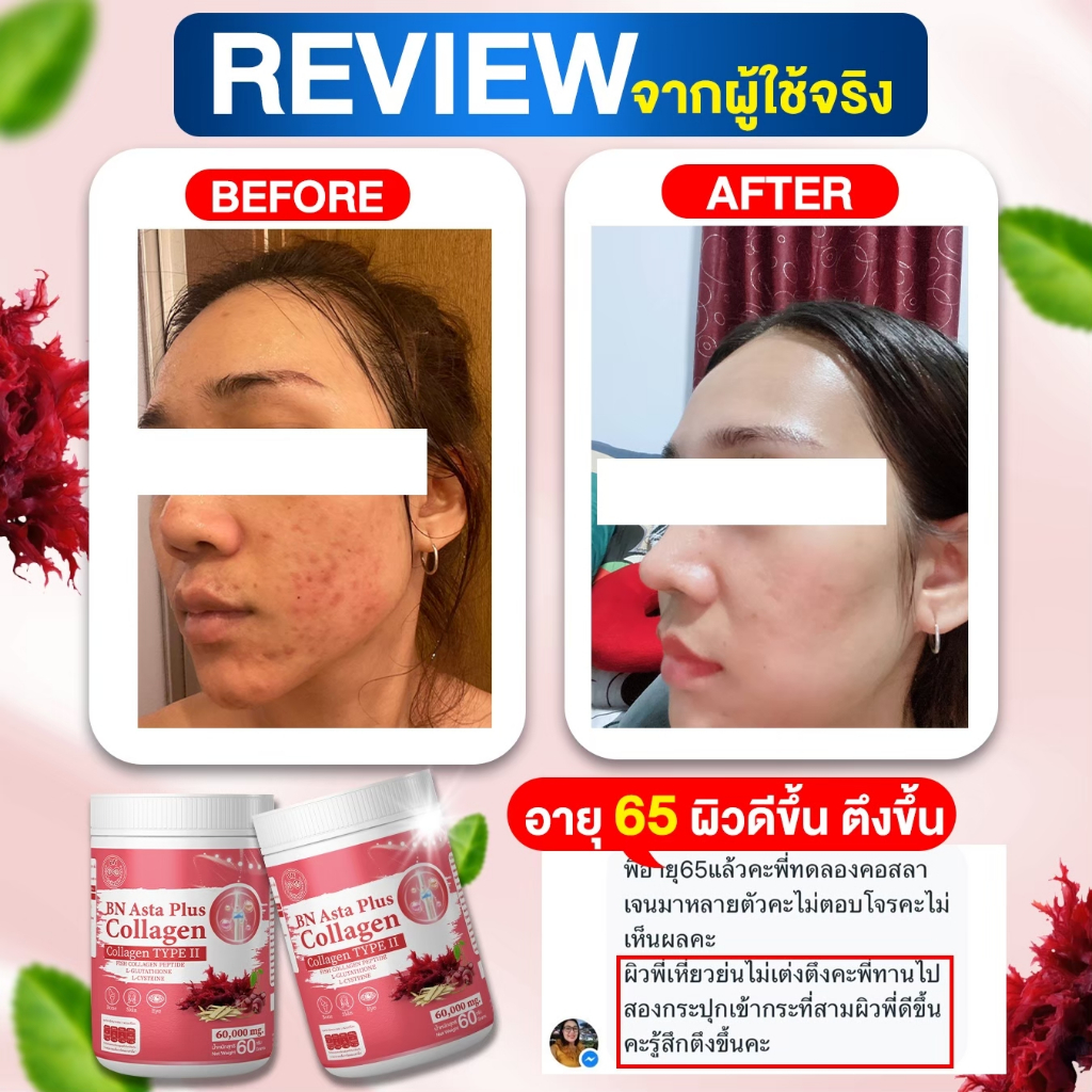 BN COLLAGEN : ขนาด120 กรัม บำรุงผิว สายตา และกระดูก (ของแท้100%)