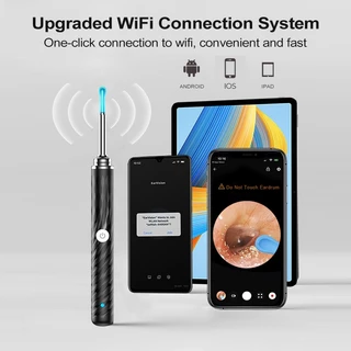 MeeGoo ที่แคะหูไม้ แคะหูอัจฉริยะ Smart Visual Ear Cleaner Stick พิกเซล 3000W ไม้แคะหูมีกล้อง