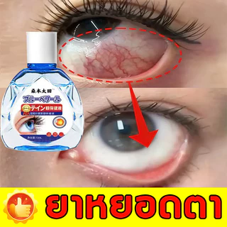 💧ลดความล้า💧 น้ำยาดูแลดวงตา น้ำยาบำรุงดวงตา ช่วยเพิ่มความชุ่มชื้น ลดความล้า ให้ความรู้สึกสบายตา ใช้ง่าย