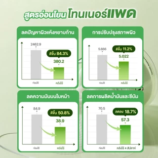 Torriden Balanceful Cica Toner Pad (60 แผ่น) - โทนเนอร์แพด สูตรอ่อนโยน ช่วยปลอบประโลมผิว