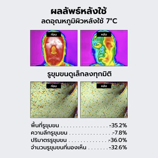 MEDICUBE Zero Pore Cooling Mask เมดิคิวบ์ ซีโร่ พอร์ คูลลิ่ง มาส์ก
