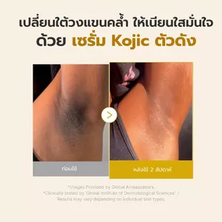 MEDICUBE Kojic Acid Turmeric Niacinamide Serum 30mL เมดิคิวบ์ โคจิก แอซิด เทอร์เมอริค ไนอาซินาไมด์ เซรั่ม