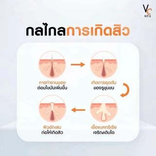 (แบบกระปุก 30g.) ครีมวิตซีน้องฉัตร Ratcha Vit C Whitening Cream วิตซี ไวท์เทนนิ่ง ครีม
