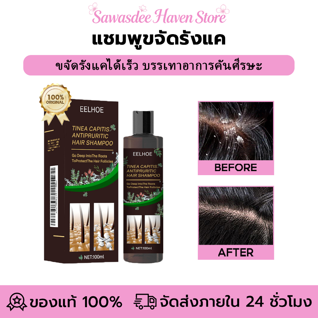 EELHOE แชมพูขจัดรังแค ยาสระผมเชื้อรา ป้องกันรังแคและลดความมัน บำรุงหนังศรีษะ ลดอาการคันศีรษะ