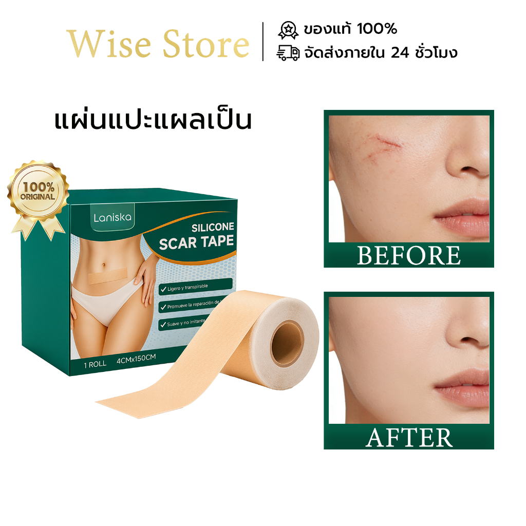 Laniska แผ่นแปะแผลเป็น แผ่นแผลเป็นซิลิโคน ลดรอยแผลเป็นนูน แผลคีลอยด์ คีลอยด์สิว Silicone Scar Tape
