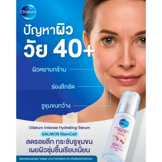 (เซ็ตพิเศษ)Oilatum Soap Bar 100g. 3 ก้อน แถมฟรี Oilatum เจนเทิล เฟเชียล เดย์ ครีม 30g.