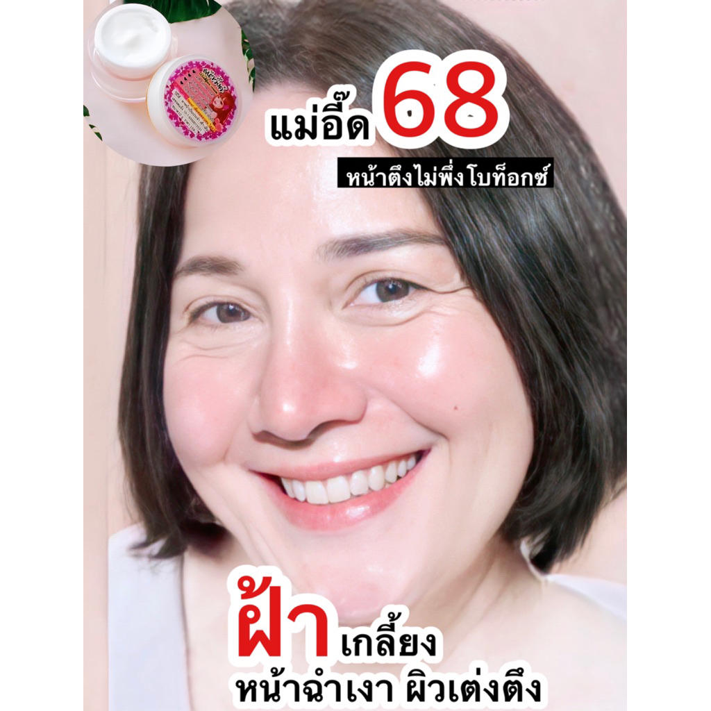 ครีมหน้าวิ๊งค์ สยบสิว สลายฝ้า หน้าฉ่ำวาวลดจุกๆ ครีมหน้าวิ้งค์(สูตรคุณหมอ)