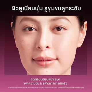 SKINTIFIC AHA BHA PHA LHA Peeling Solution serum essence เซรั่มเพื่อการ โทนอัพ ที่มีส่วนผสมของ AHA BHA น้ําตบ โทนเนอร์