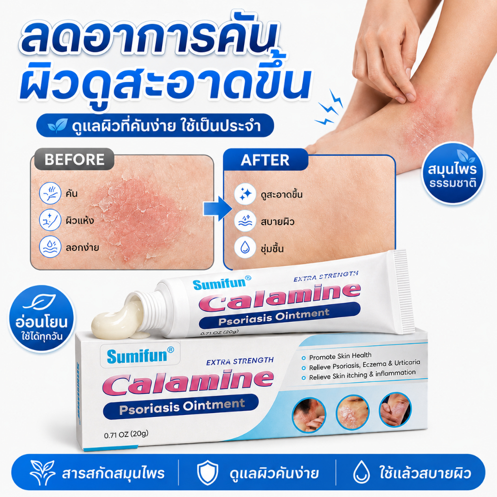 🔥[หยุดคันไว]🔥ครีมแก้ผื่นคัน ช่วยบรรเทาอาการคัน ผิวหยาบกร้าน และผิวลอก ซึมซาบง่าย ไม่เหนียวเหนอะหนะ