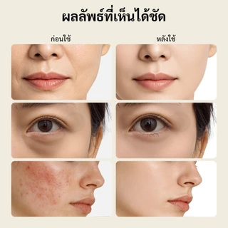 GOKOCO เครื่องยกกระชับหน้า EMS แสงบำบัด 3 สี ชาร์จ Type-C เครื่องนวดหน้า ยกกระชับผิว ลดเลือนริ้วรอย รับประกัน 1 ปี