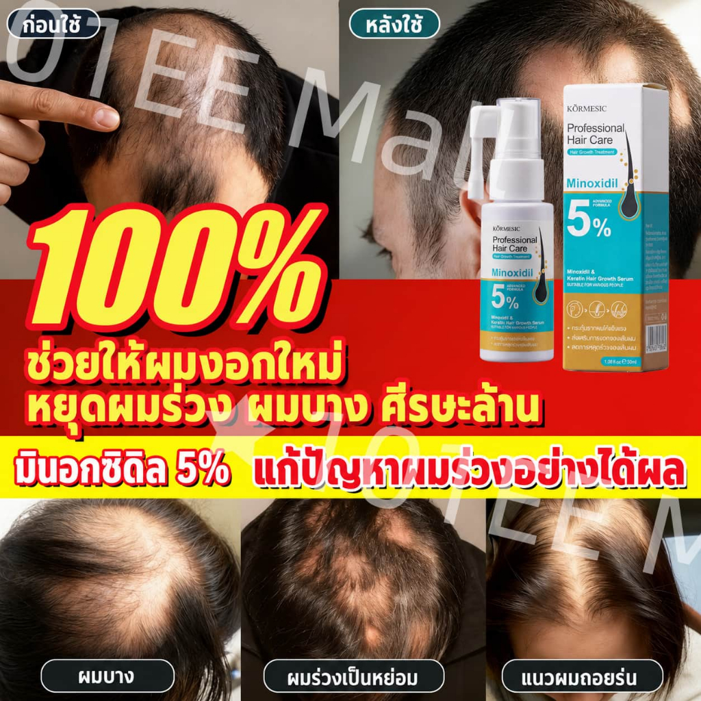 เร่งผมยาว เร่งผมยาวแบบเร่งด่วน ยาเร่งผมยาว สเปรย์ปลูกผม ลดผมร่วง ยา ปลูก ผม ผมหนา ยาแก้ผมร่วง ผมร่วง ผมบาง
