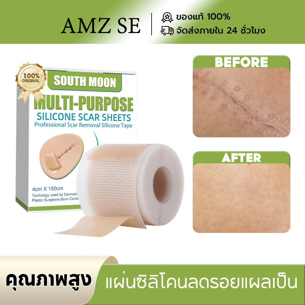 【ลบรอยแผลเป็น】South Moon แผ่นแปะแผลเป็น แผ่นซิลิโคนเจล แผ่นปิดรอยแผลเป็น ลบรอยแผลเป็นแผลผ่าตัด ลดรอยแผลเป็นนูน