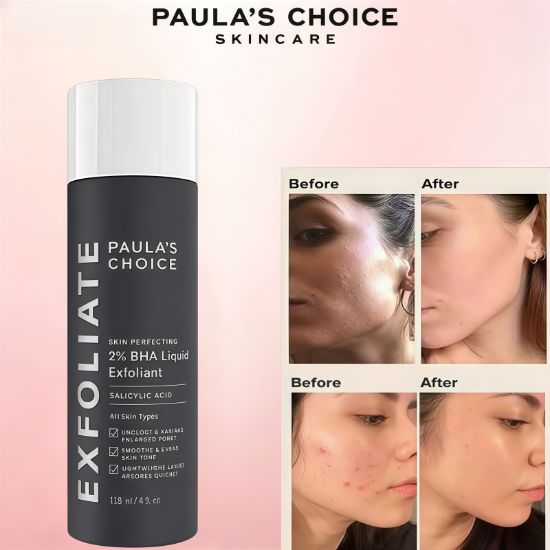 【แนะนำสินค้าแท้】PAULAS CHOICE ขนาดทดลอง Skin Perfecting BHA Liquid เนื้อน้ำ ลดการเกิดสิว 118ml