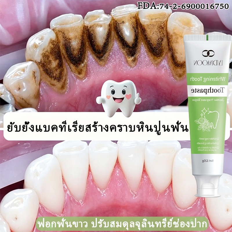 LYDIMOON ยาสีฟันโปรไบโอติก ยาสีฟันฟอกฟันขาว 120g ขจัดทาร์ทาร์ ดับกลิ่นปาก ปรับสมดุลกลุ่มแบคทีเรียในช