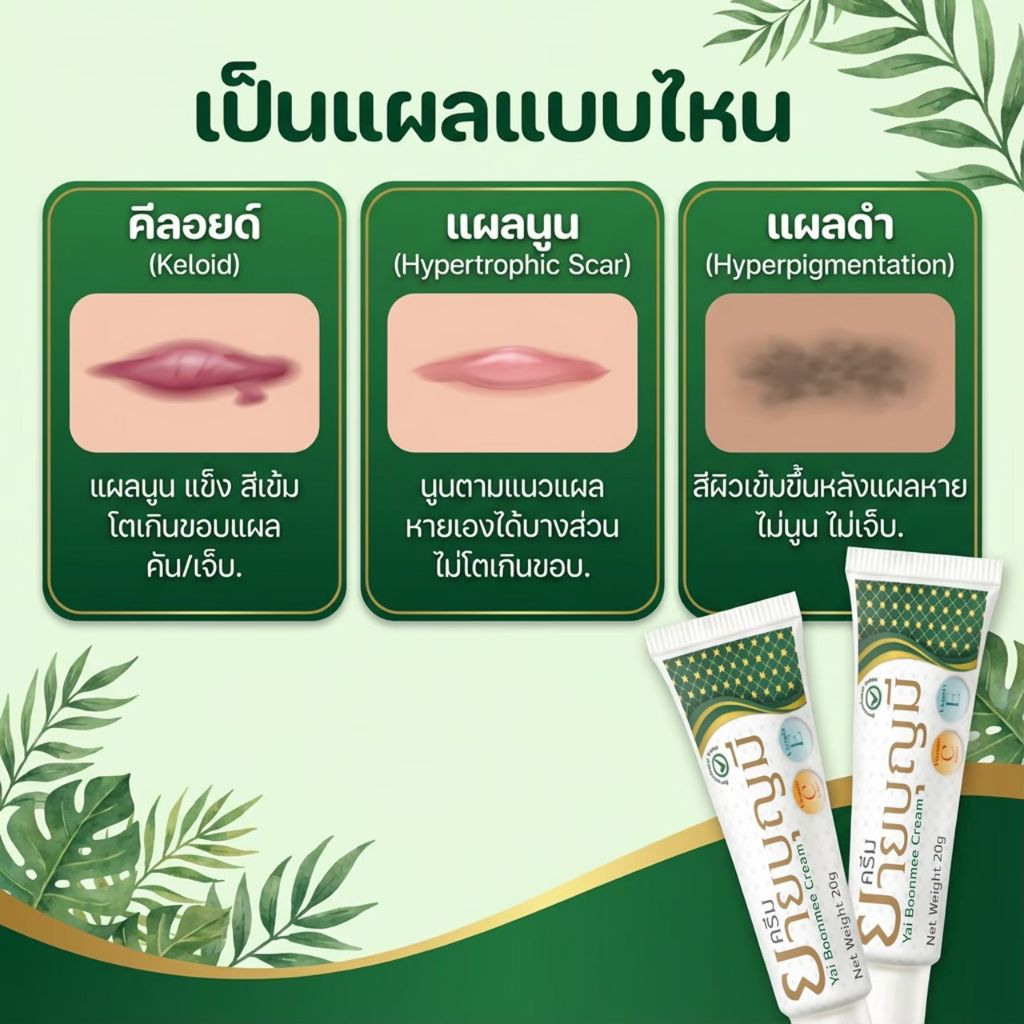 ยายบุญมี ครีมยายบุญมี ช่วยลดรอยแผลเป็น รอยสิว รูปที่ 3
