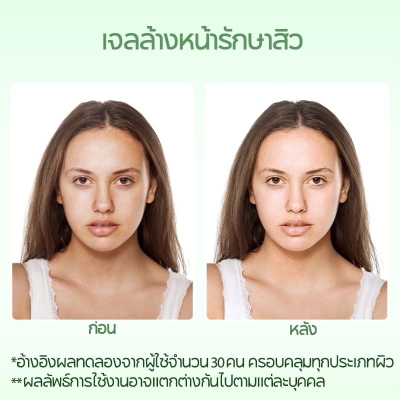 PAZIUM เจลล้างหน้า Cleansing Gel ลดสิว ขจัดเซลล์ผิวเก่า ลดรอยสิว ควบคุมความมัน รูขุมขนกระจ่างใส 120G thumbnail 5
