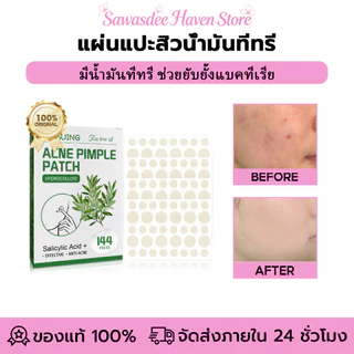 Jaysuing แผ่นแปะสิวน้ำมันทีทรี แผ่นแปะสิวแบบมองไม่เห็น แผ่นแปะสิวแบบไร้รอย แต่งหน้าได้ แปะสิวซ่อนรอย แผ่นแปะสิว กันน้ำ