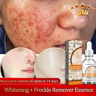 ครีมทาฝ้า 30ml ขจัดฝ้ากระ จุดดำ ผิวหน้าขาวใส