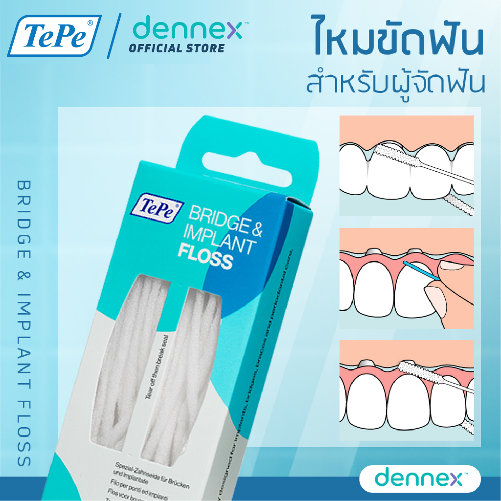 TePe Bridge & Implant floss ไหมขัดฟันสำหรับผู้ที่ทำรากฟันเทียมสะพานฟันหรือผู้ที่ใส่เครื่องมือจัดฟัน 1 กล่อง