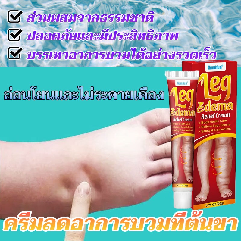 ครีมลดอาการบวมที่ต้นขา ครีมบรรเทาอาการบวมที่ขา  ครีมลดอาการบวมที่ขา ออกฤทธิ์เร็ว เหมาะสำหรับลดอาการบวมที่ขาและข้อเท้า