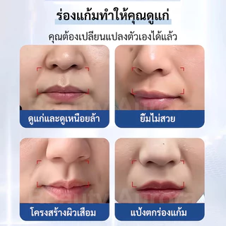 แผ่นแปะร่องแก้มลึก แผ่นมาร์คร่องแก้ม ลดริ้วรอยร่องแก้ม กระชับยกกระชับ ลบร่องลึก หน้าเด้งเรียบเนียน เทปยกกระชับผิว