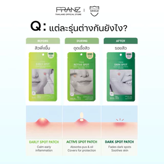 FRANZ Naked Spot Step3 Dark Spot แผ่นแปะสิวล่องหนกัน UV UPF50+ สำหรับรอยสิว (72ชิ้น)