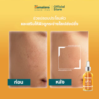 Himalaya Dark Spot Treatment Turmeric Face Serum 15ml. - เซรั่มขมิ้นชันเข้มข้น