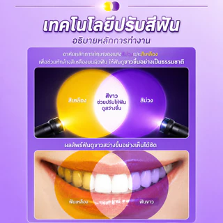 【ซื้อ 1 แถม 1】YOOMU ยาสีฟันสีม่วง ฟอกฟันขาว 50g ลดคราบเหลือง ไฮดรอกซีอะพาไทต์ ลดเสียวฟัน ลดกลิ่นปาก