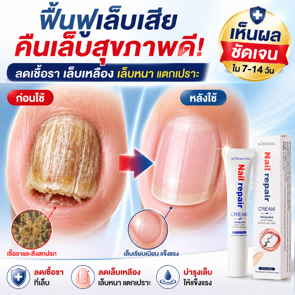 ครีมบำรุงเล็บ เซรั่มดูแลเล็บมือและเท้า ช่วยให้เล็บดูสะอาด สุขภาพดี ลดเล็บเหลือง ใช้งานง่าย เหมาะสำหรับใช้ประจำวัน