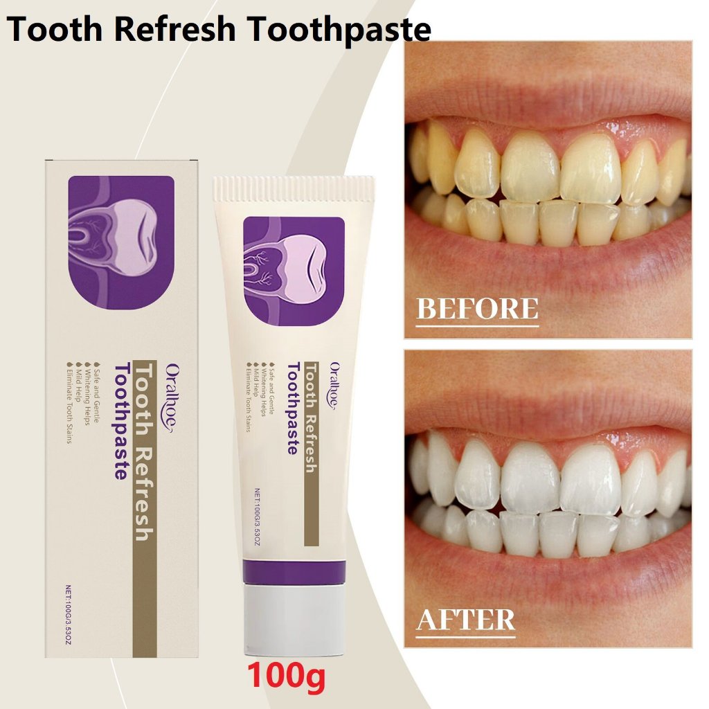 【พร้อมแล้ว】ยาสีฟัน Oralhoe Tooth Refresh - ยาทำความสะอาดฟันอ่อนโยน ขจัดฟันสกปรกและทำความสะอาดฟัน (10