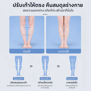 แผ่นรองเท้ารองรับและปรับอุ้งเท้า แก้ไขขา O และเท้าแบนในชีวิตประจำวัน โฟมเมมโมรี่พรีเมียม บรรเทาอาการปวด