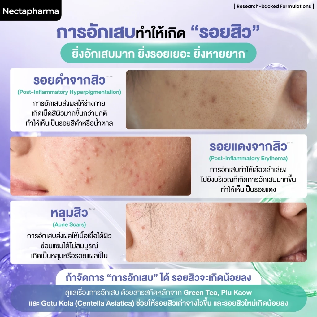 Nectapharma Pearletane เพิร์ลลีเทน วิตามินสวบสิว กู้หน้าสิว บิ๊วหน้าใส วิตามินลดสิว ซิงค์ลดสิว ลดสิวฮอร์โมน ลดรอยสิว thumbnail 5
