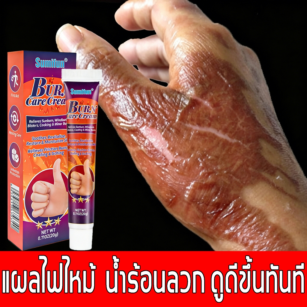 ครีมทาแผลน้ำร้อนลวก เหมาะสำหรับแผลสด ลดอาการปวดและบวม ส่วนผสมจากธรรมชาติ อ่อนโยน ปลอดภัย ซ่อมแซมผิว ครีมทาแผลไฟไหม้