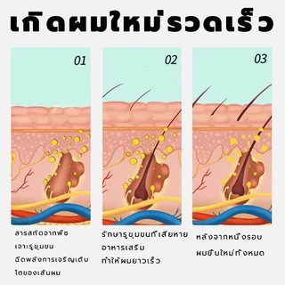 แชมพูขิงบำรุงรากผม ลดผมร่วง เร่งผมยาว ปรับปรุงสภาพเส้นผมที่อ่อนแอ
