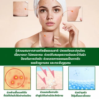 เซรั่มลดสิว 30ml ครีมเจลแต้มรักษาสิว กำจัดสิว ลดรอยสิว ทำรอยสิวจางลง