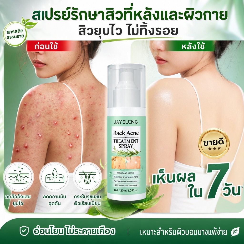 120ml สเปรย์ดูแลสิวที่หลัง กำจัดแอคเน่และสิวตามร่างกาย ลดไร ครีมแต้มสิว