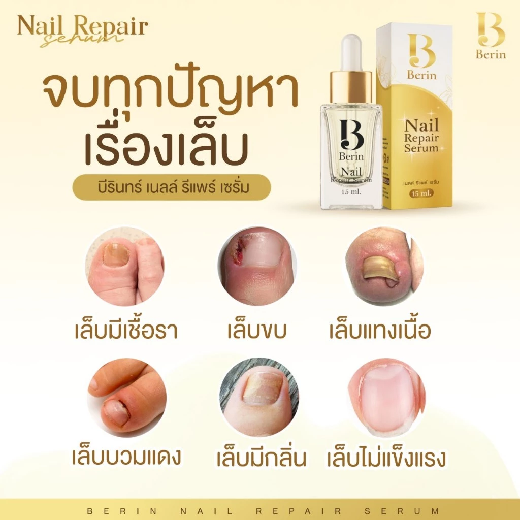 (พร้อมส่ง💛) Berin บีรินทร์ เซรั่มบำรุงเล็บ ซ่อมแซมเล็บเสีย เล็บเชื้อรา เล็บขบ เล็บเจล ทำให้เล็บสวยสุขภาพดี