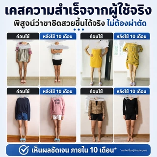 แผ่นรองเท้ารองรับและปรับอุ้งเท้า แก้ไขขา O และเท้าแบนในชีวิตประจำวัน โฟมเมมโมรี่พรีเมียม บรรเทาอาการปวด