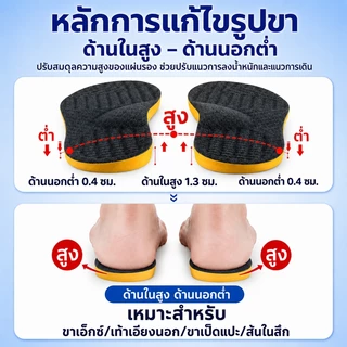 แผ่นรองเท้าเพื่อสุขภาพ แผ่นรองเท้าแก้ไขขา X / ขา O ลดอาการปวด รองรับอุ้งเท้า ลดความเมื่อยล้าจากการยืนนาน
