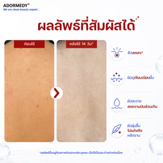 [2 ก้อน] ชาร์โคโลจี สบู่ก้อนสูตรลดสาเหตุการเกิดสิว Charcoalogy Acne Clearing Face and Body Clay Soap